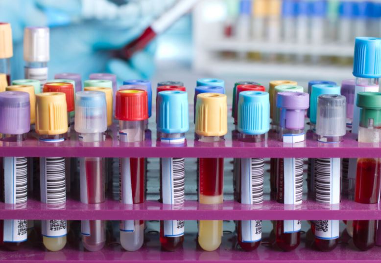 93303blood vials